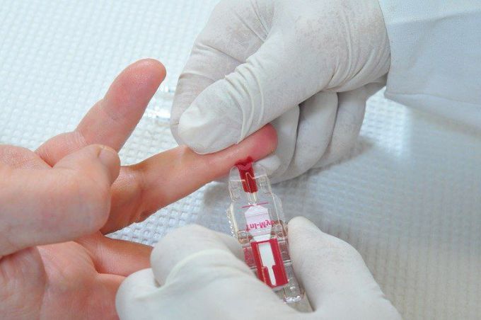 Розшифровка аналізу крові: чому показники не в нормі